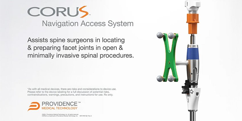 A Universal Spine Surgery NAV System?
