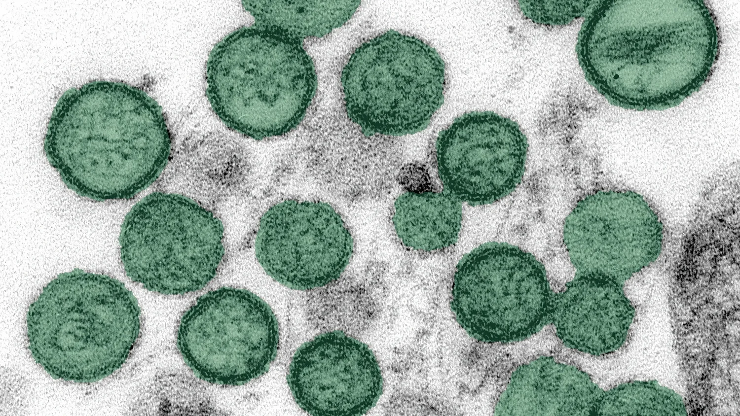 Could hantavirus become the next pandemic? Georgia officials monitor couple exposed on cruise ship