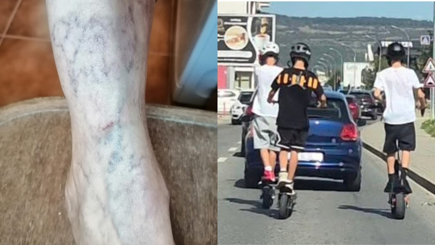 Femeie de 66 de ani, lovită de un copil pe trotinetă la Sibiu: ,,Îmi e frică să mai ies pe stradă”