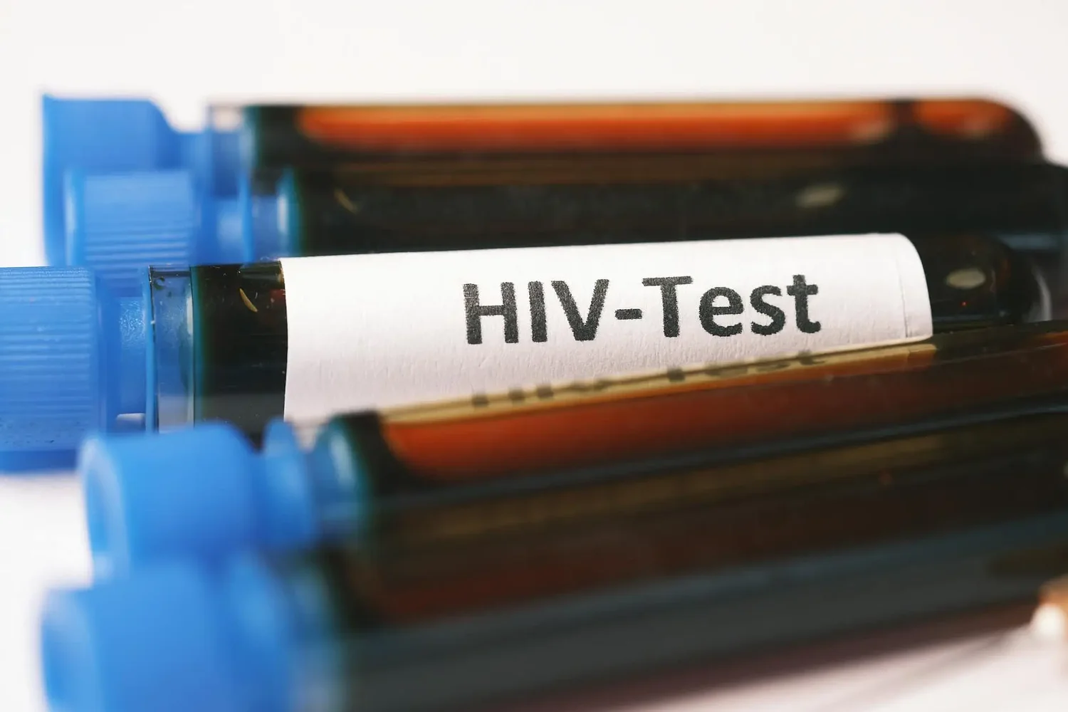 HIV treatment saved Georgia over $100 billion, study finds