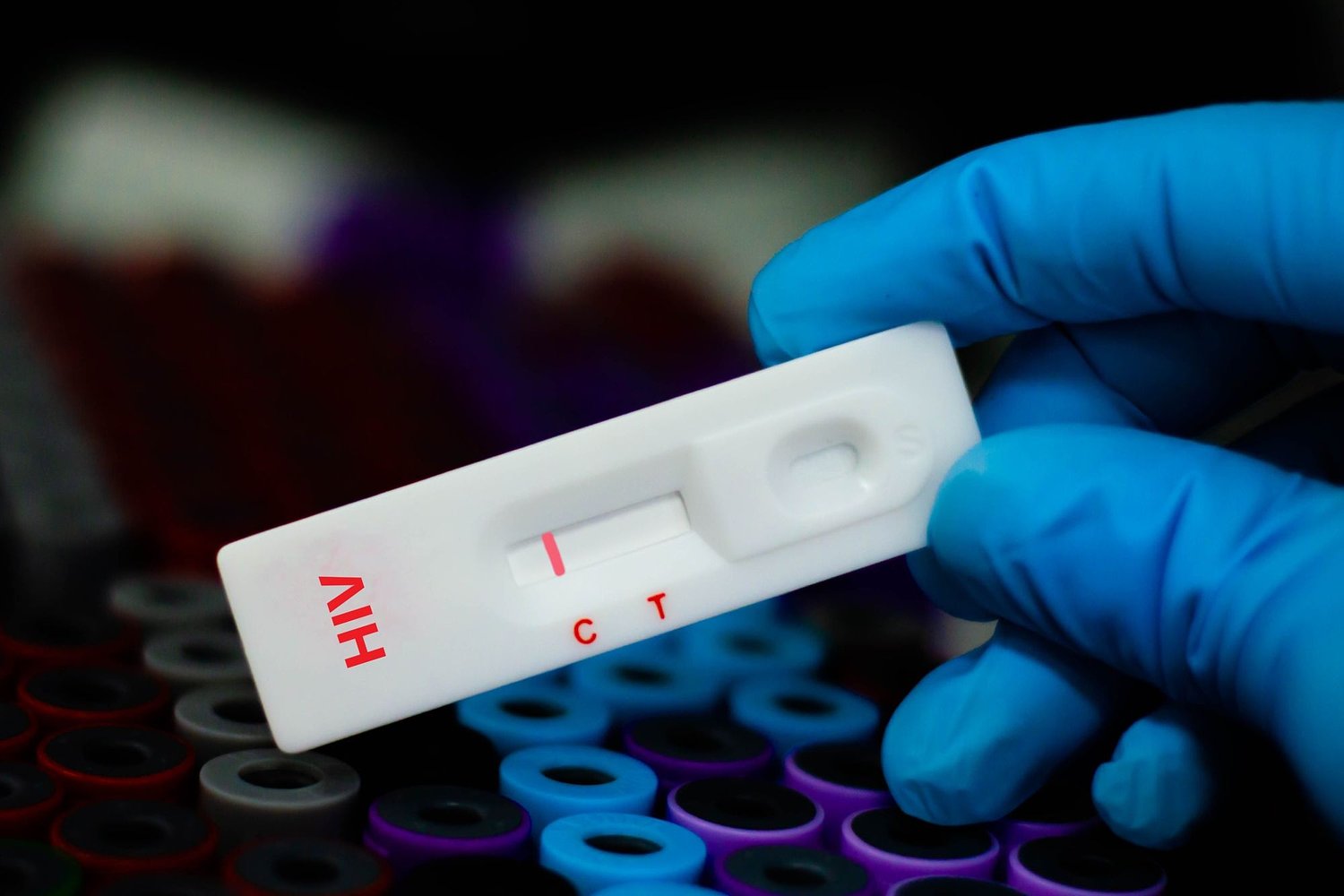 County eliminates 11 positions in disease investigator sector