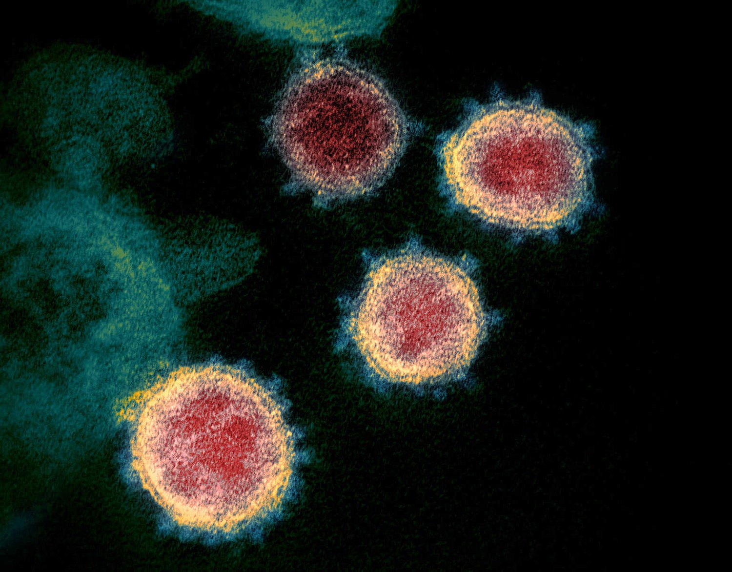 Virologists push back on more regulation of viruses made more lethal in the lab