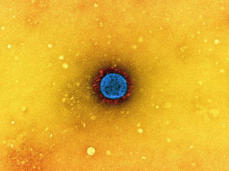Virus hunter at center of ‘lab leak theory’ grilled by congressional committee
