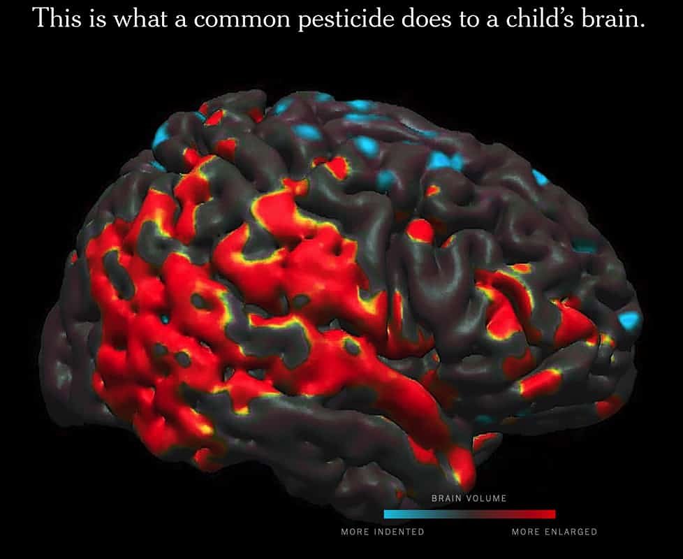 Chlorpyrifos: Pesticide tied to brain damage in children