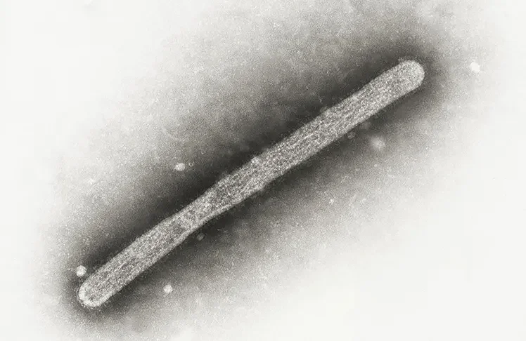 US CDC Confirms First Human Case Of Avian Influenza In Nevada