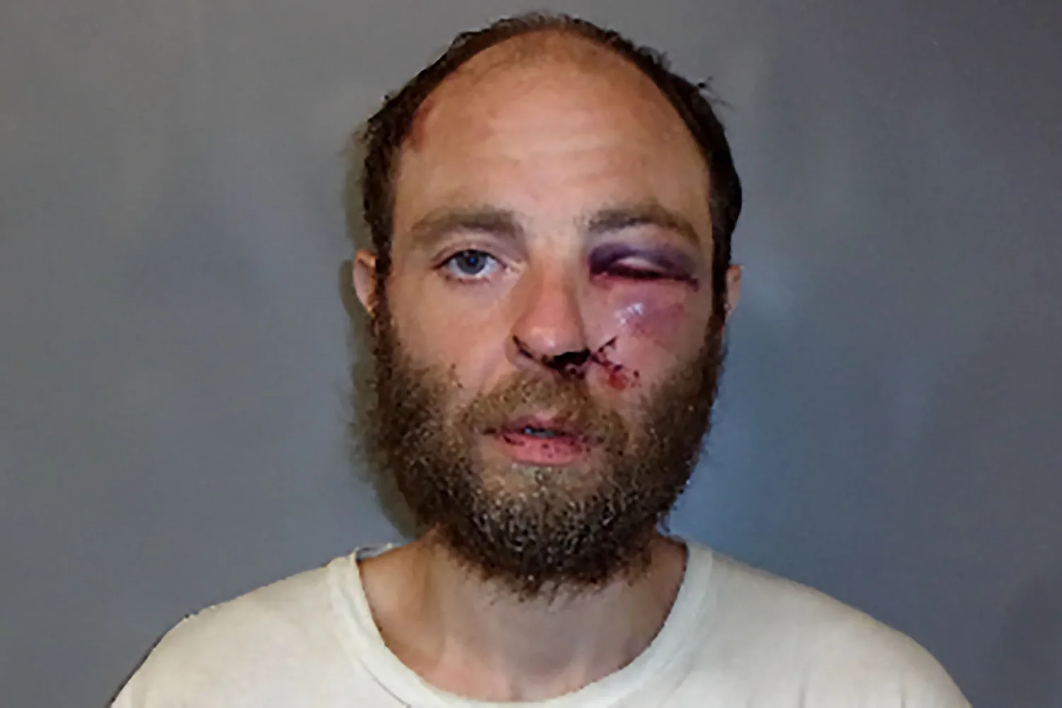 Police: Man charged in shelter attack arrested again in Lebanon