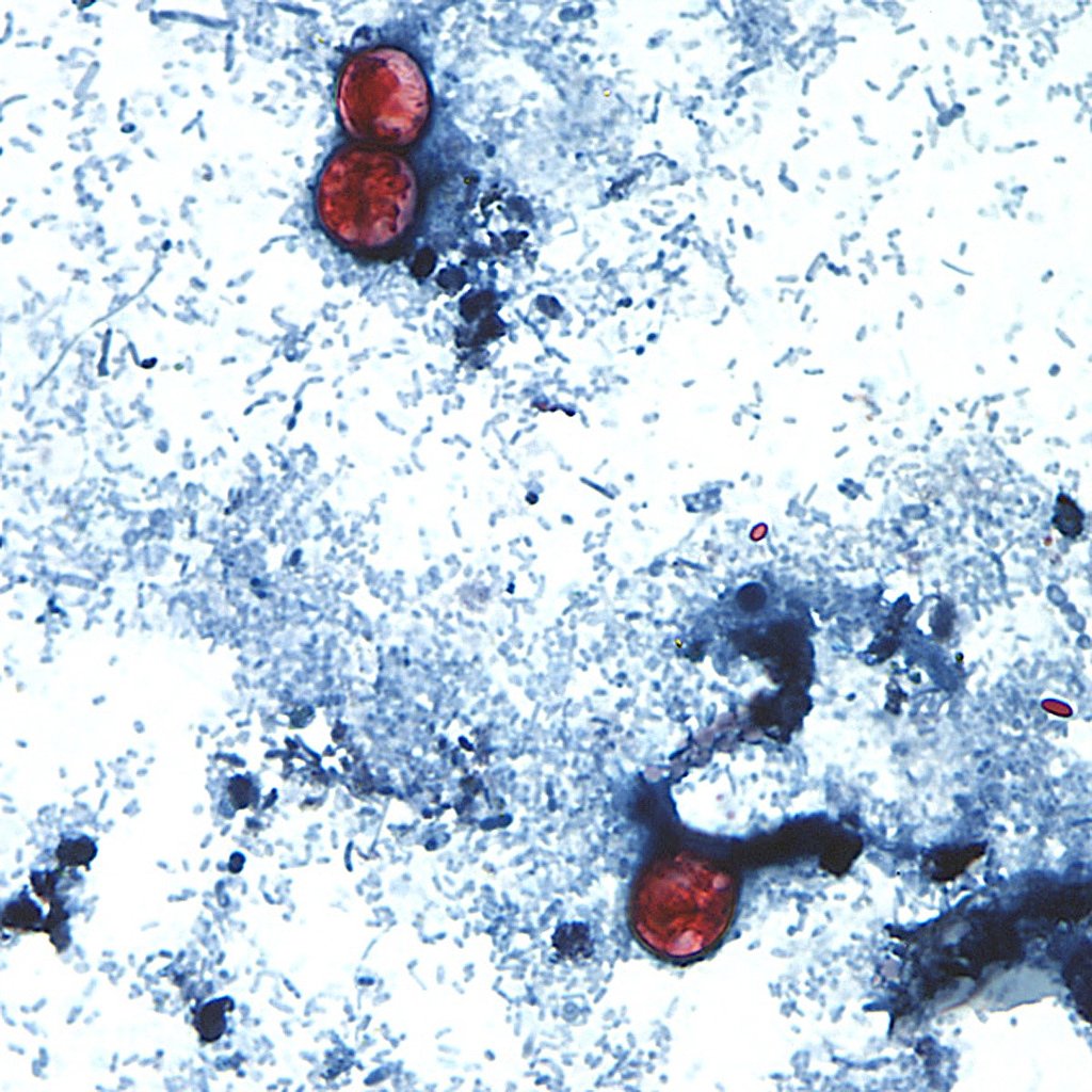 Michigan parasite outbreak linked to 3 other states with a likely common source
