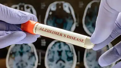 Active Aging: What's new in Alzheimer's and dementia research