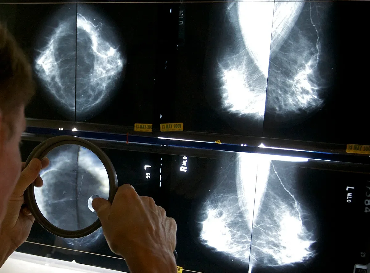 Expanding access to cancer screenings in Maine can save lives