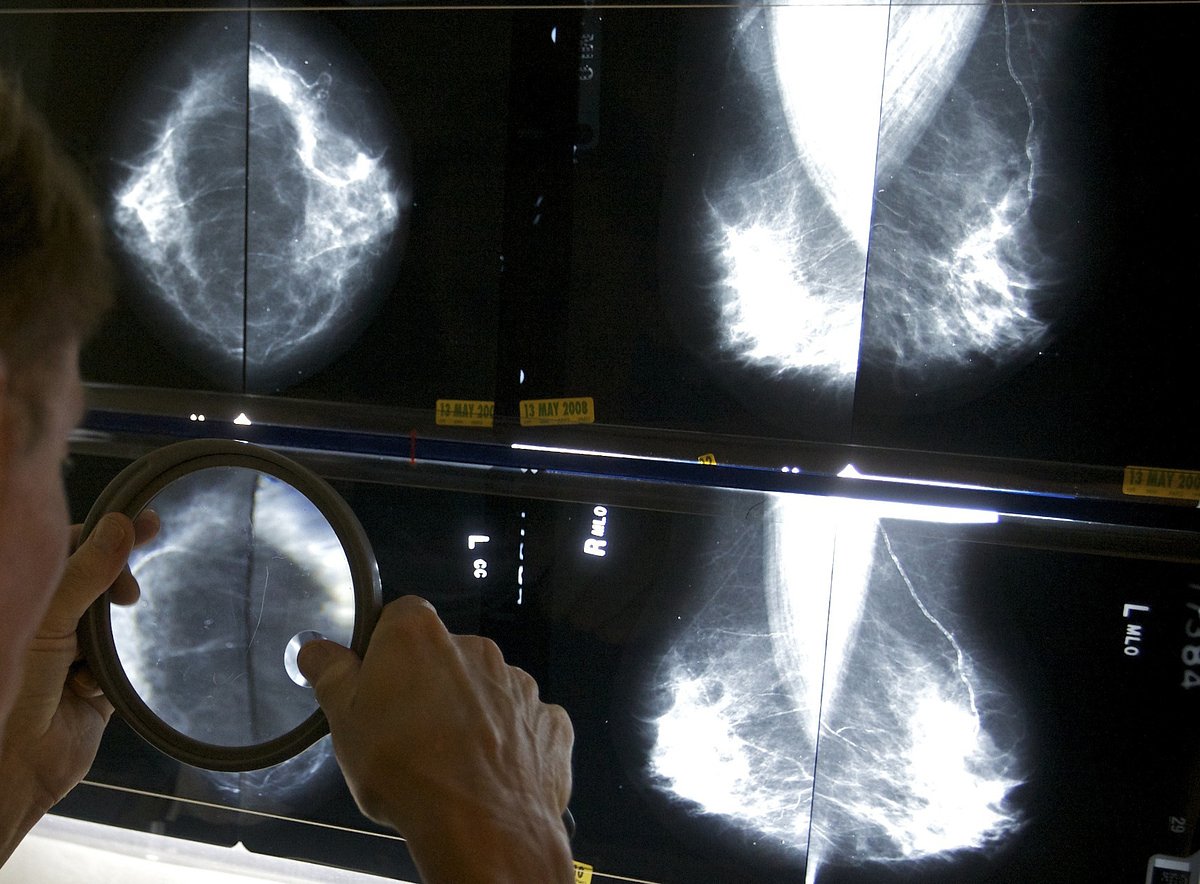 Expanding access to cancer screenings in Maine can save lives