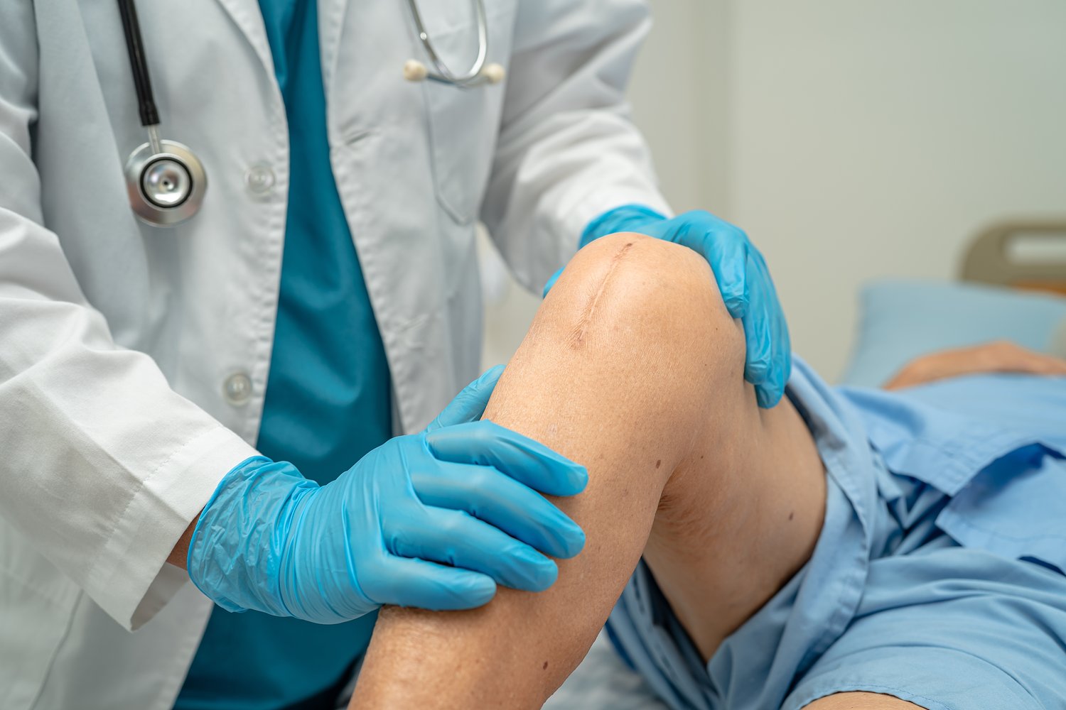Physical therapist with a new knee clarifies what to expect after joint replacement surgery