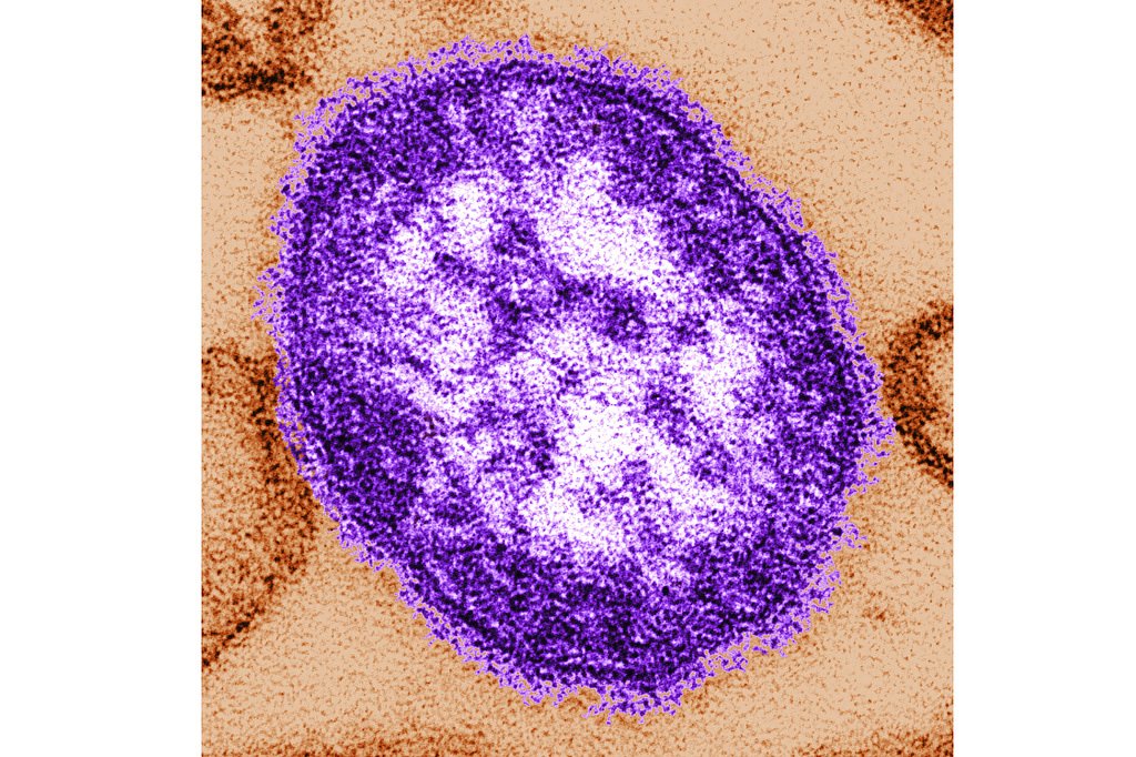 Coroner releases details of infants who died amid growing Pennsylvania measles outbreak