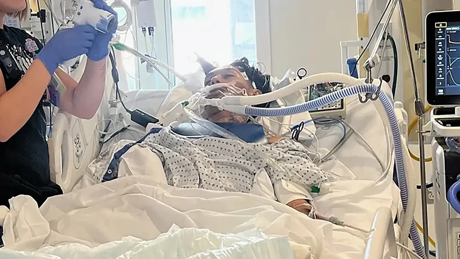 North Carolina teenager infected with brain-eating amoeba has died