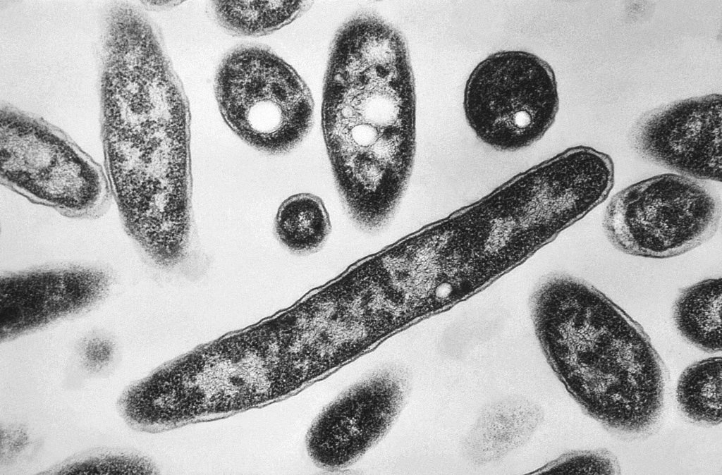 Second death reported in Legionnaires’ disease outbreak in New York City