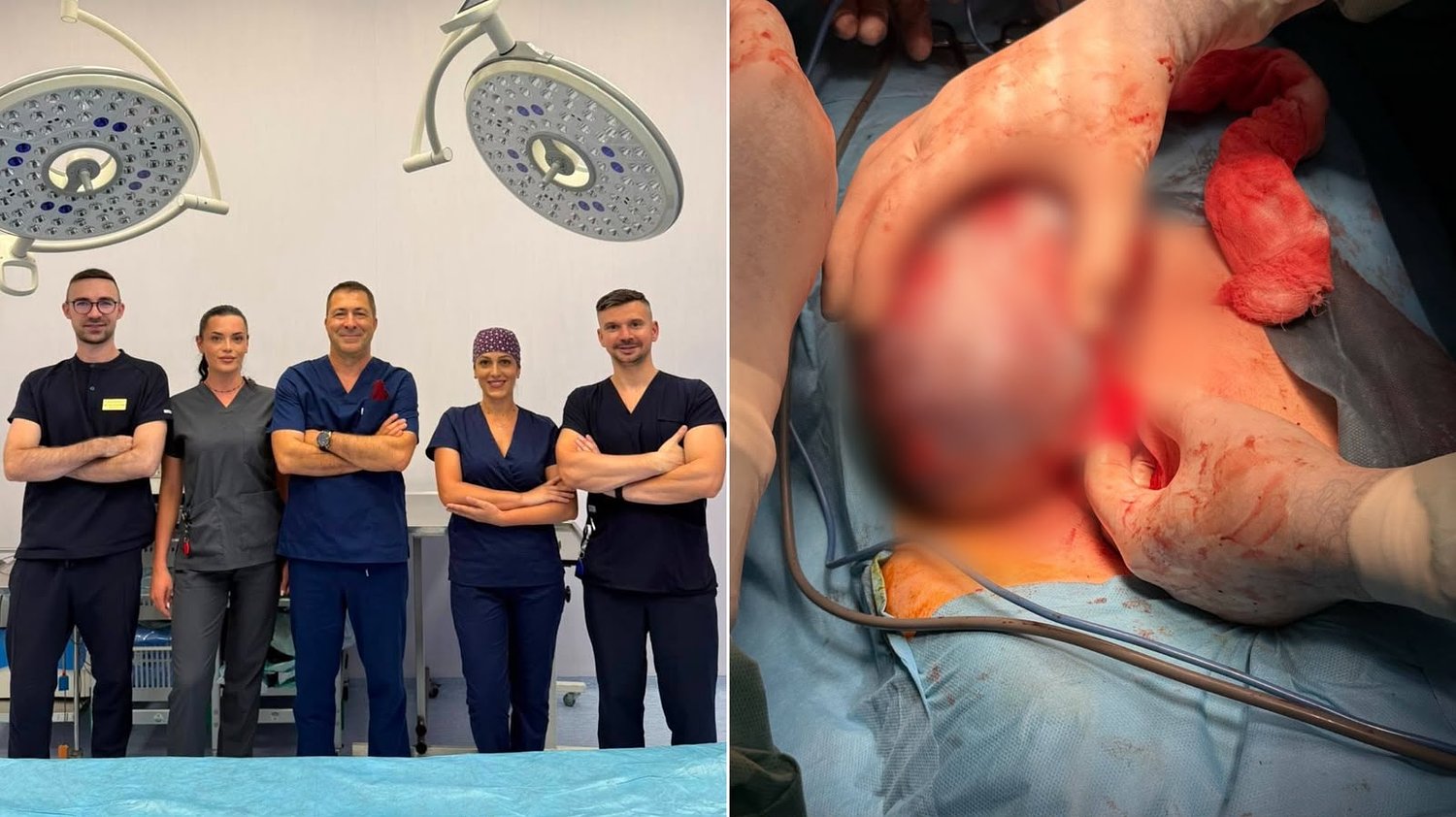 Tumoră cât o găleată, extirpată cu succes la Sibiu: intervenție impresionantă a medicilor de la Spitalul Județean / foto