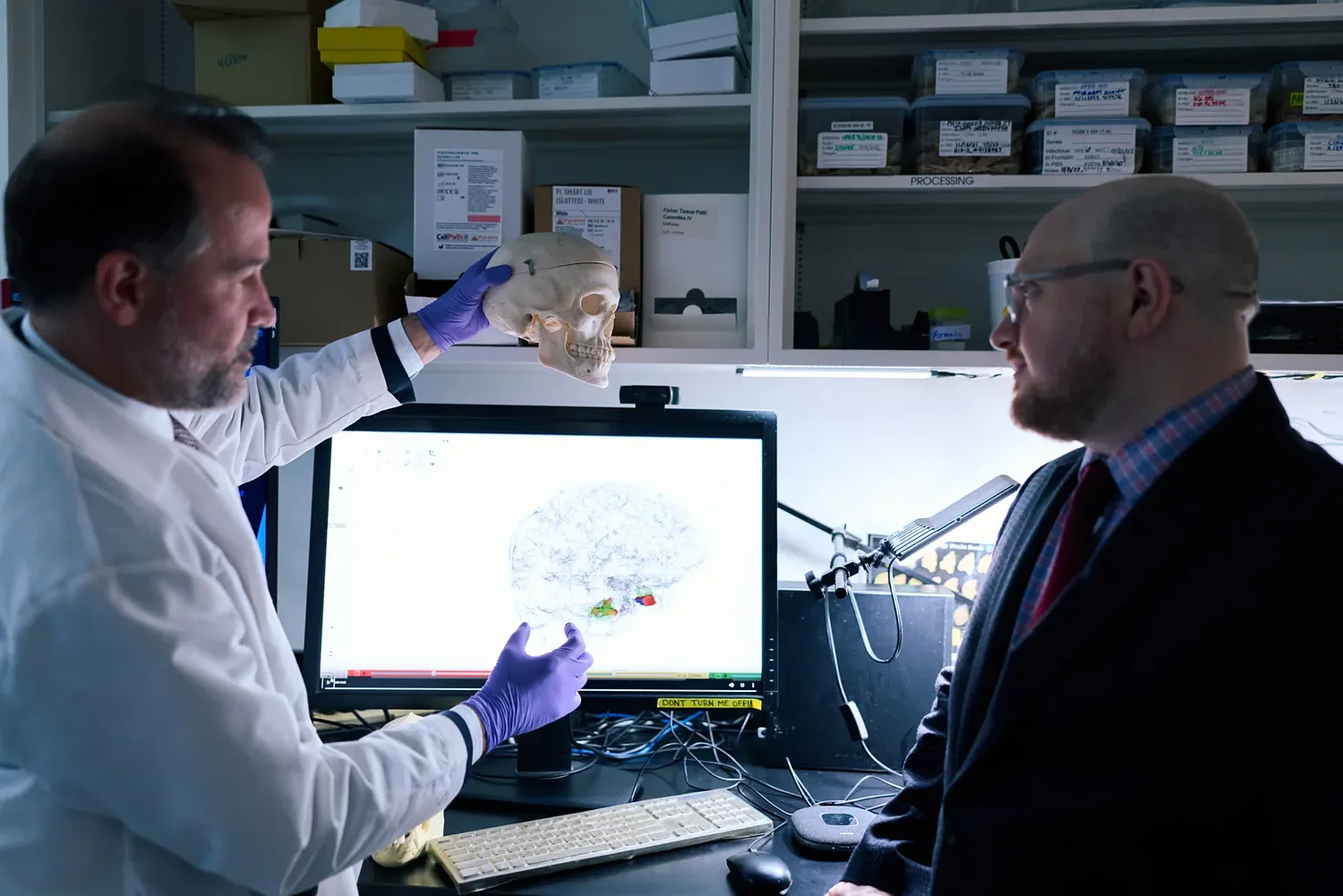 Alzheimer's researchers look at an unusual data point: Head shape
