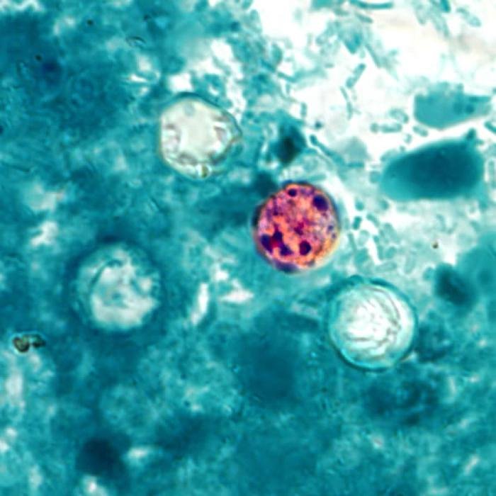 Monadnock Community Hospital prepares for rising Cyclospora cases