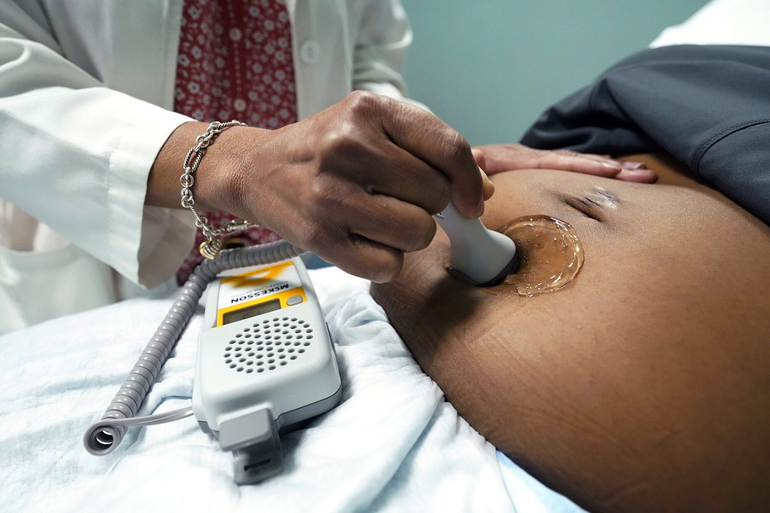 Report finds birth centers improve outcomes. Mississippi has none