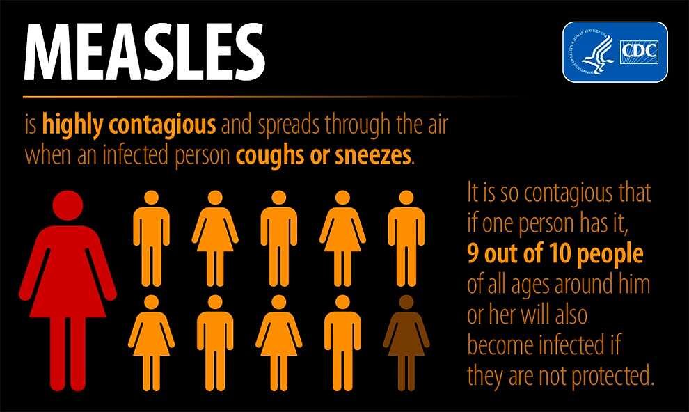 Health officials warn of measles spread before summer