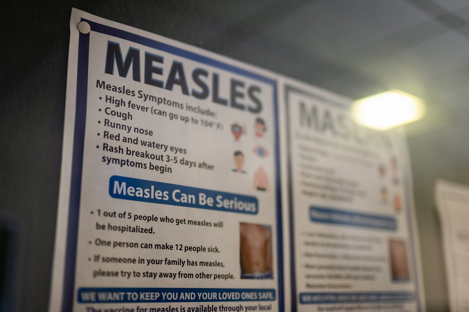 Officials confirm three measles cases in Montgomery County