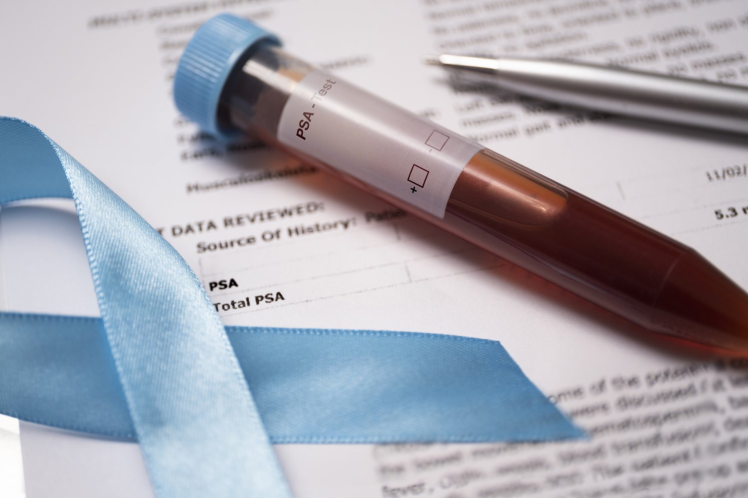 Early detection saves lives only when patients can access care -- Opinion