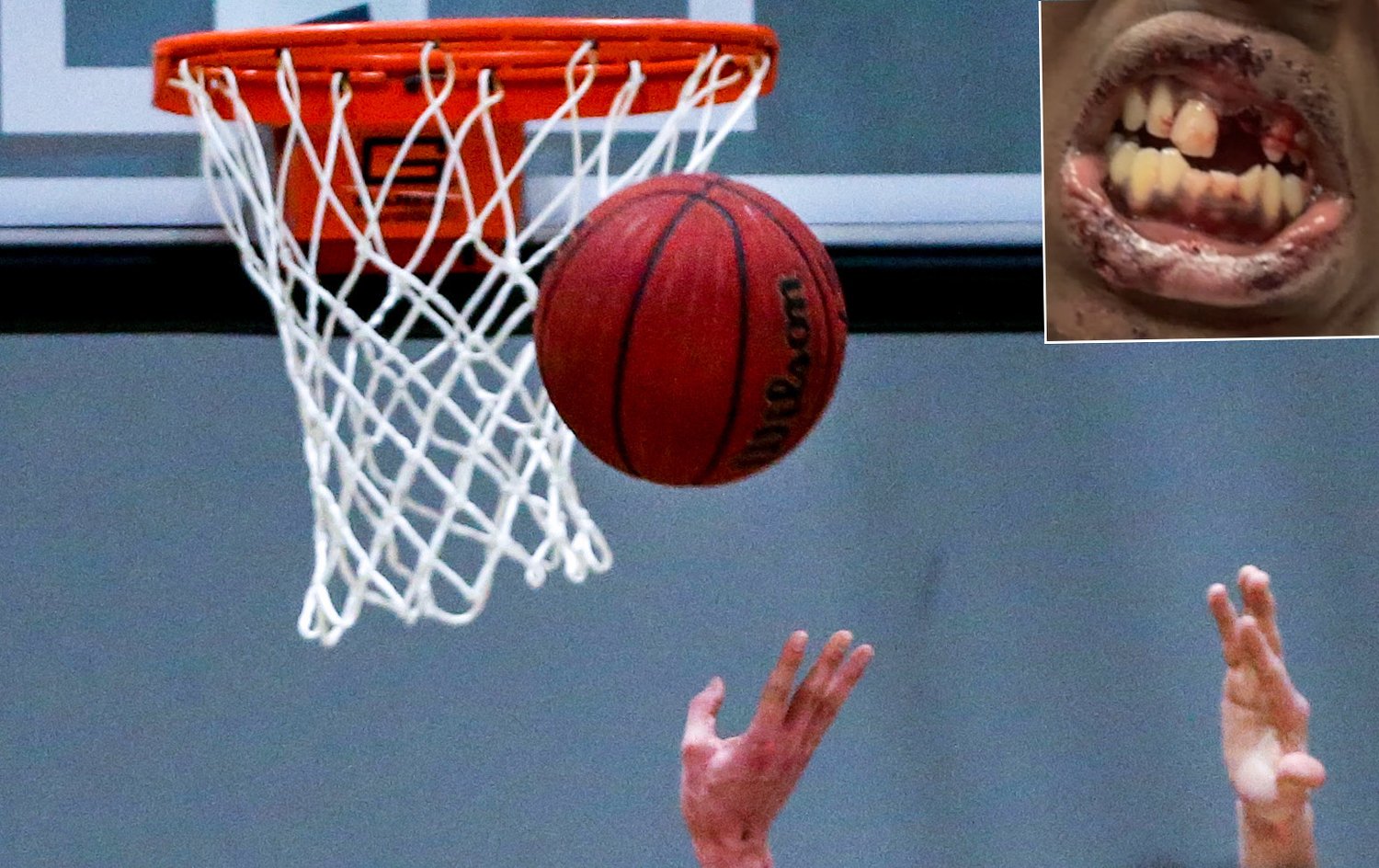 Comment about Staten Island teen hurt in NYPD encounter sparks basketball league controversy