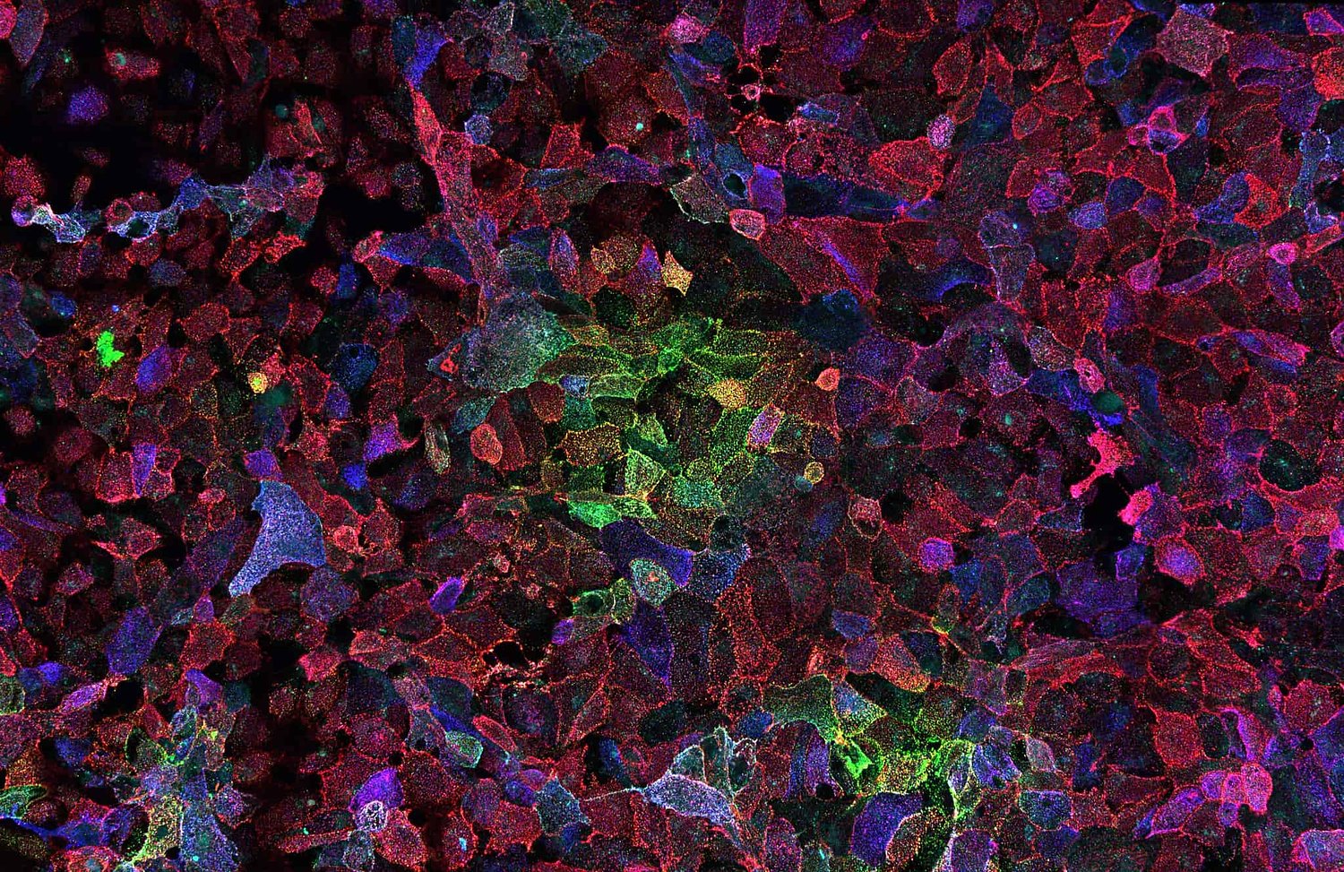 NIH gain-of-function regulations are vague and secretive,  advisers say