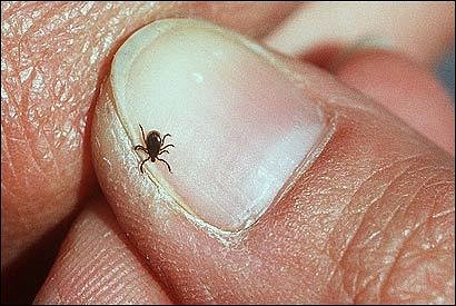 Kane County Health Department offers tick removal kits