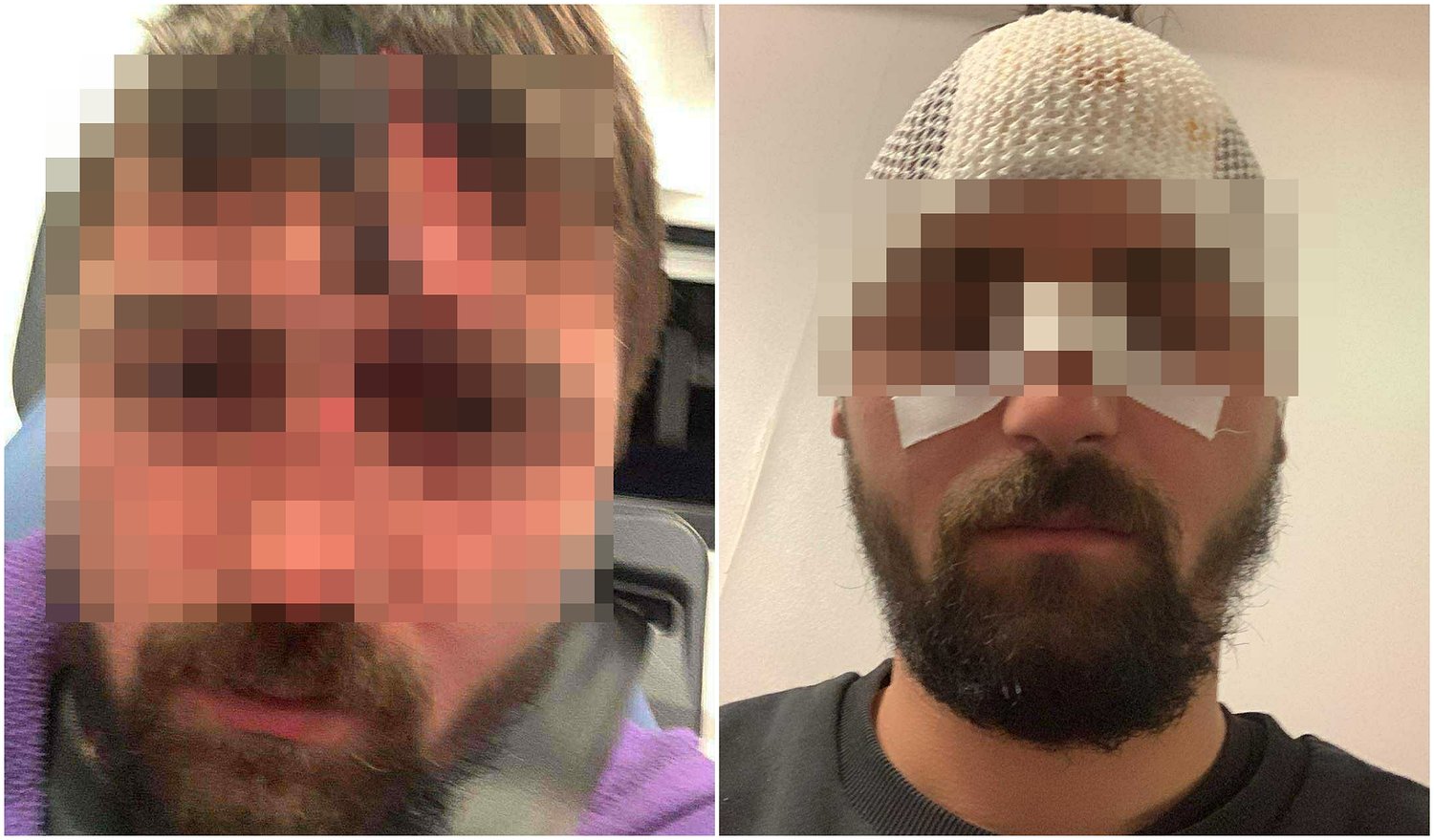 Scandal pe stradă la Roșia. Trei bărbați spitalizați: „Mi-au dat cu bâta în cap” / foto