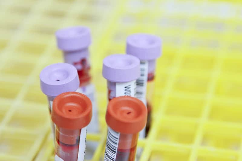 Beijing ordered destruction of early coronavirus samples, secret memo shows