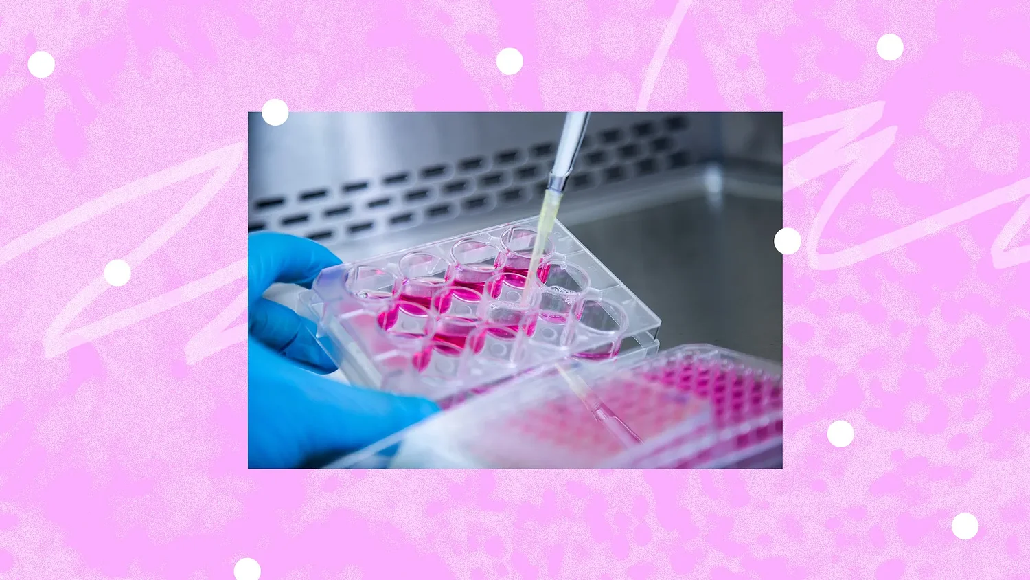 Will there soon be a cure for HIV?